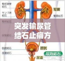突发输尿管结石止痛方法：输尿管结石突发怎么办 