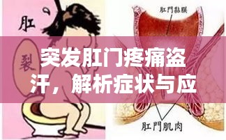 突发肛门疼痛盗汗，解析症状与应对良方