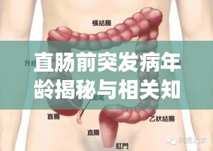 直肠前突发病年龄揭秘与相关知识深度解析