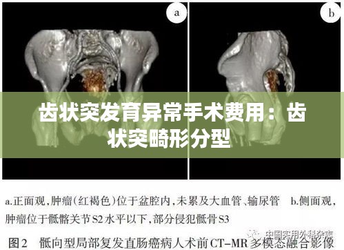 齿状突发育异常手术费用：齿状突畸形分型 