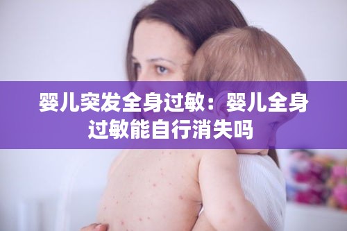 婴儿突发全身过敏：婴儿全身过敏能自行消失吗 