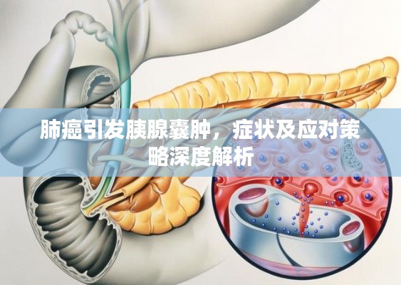 肺癌引发胰腺囊肿，症状及应对策略深度解析