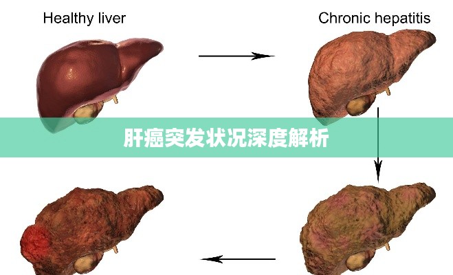 肝癌突发状况深度解析