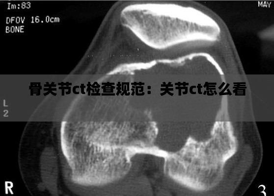 骨关节ct检查规范：关节ct怎么看 