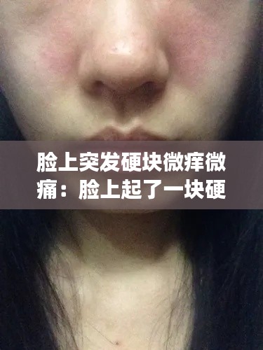 脸上突发硬块微痒微痛：脸上起了一块硬硬的很痒 