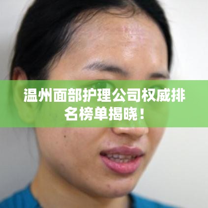 温州面部护理公司权威排名榜单揭晓！