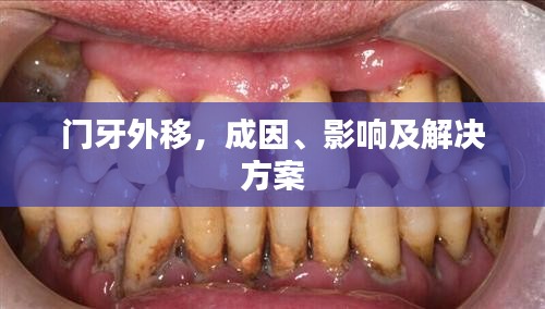 门牙外移，成因、影响及解决方案