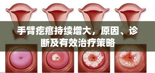 手臂疙瘩持续增大，原因、诊断及有效治疗策略